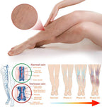 Varicose Veins Treatment Spray (Pack Of 2)